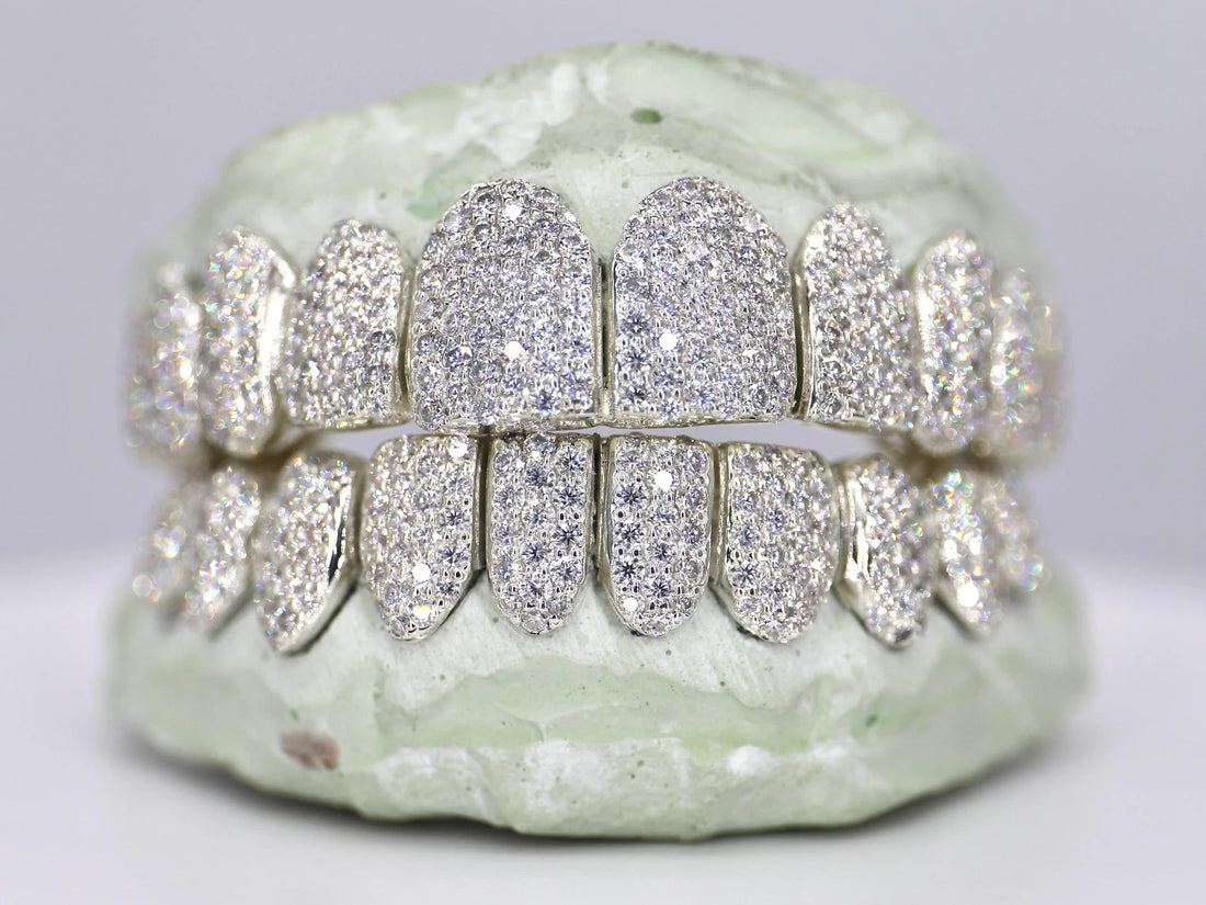 10 on 10 VS Diamond Grillz